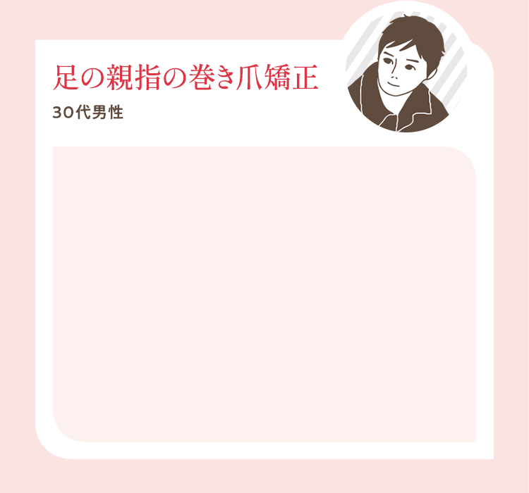 足の親指の巻き爪矯正