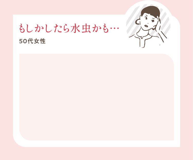 もしかしたら水虫かも…